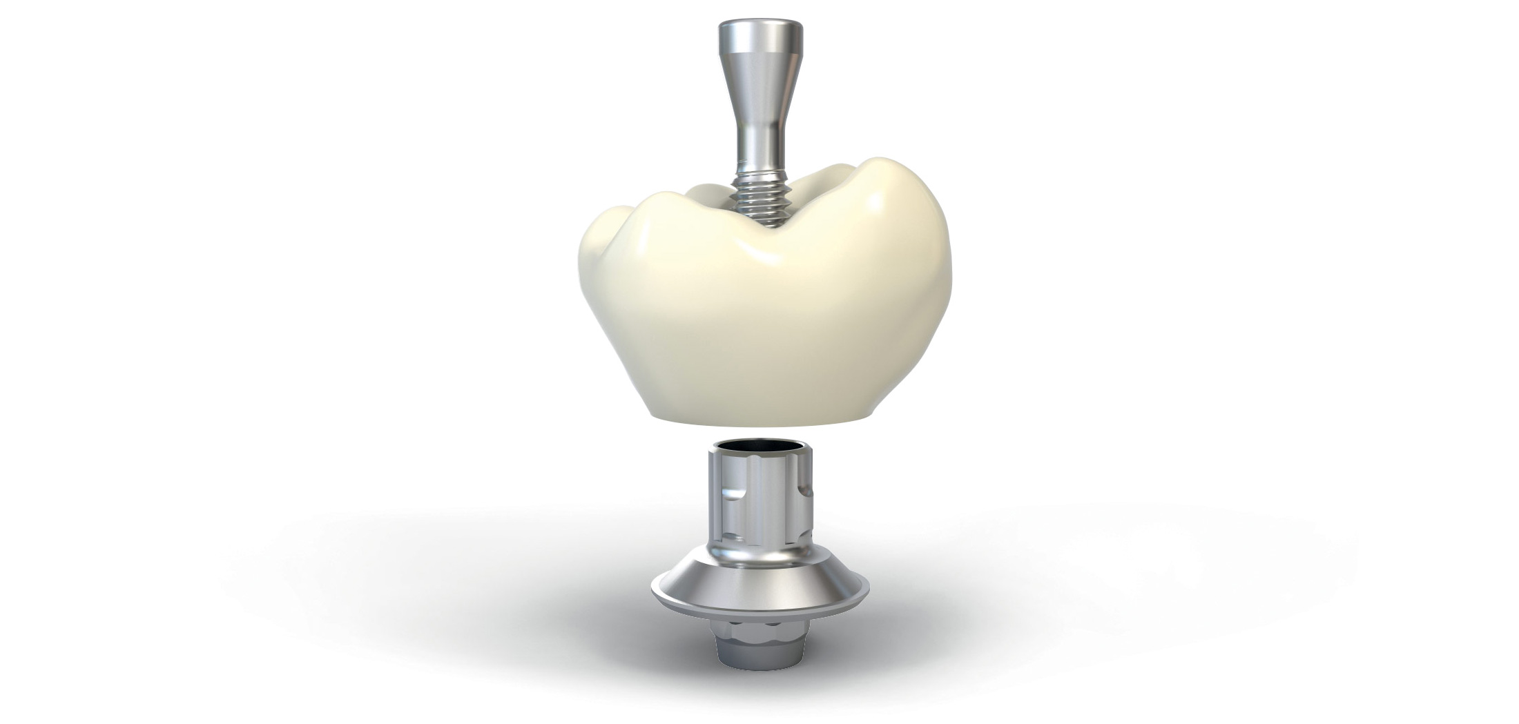 Couronne hybride sur implant