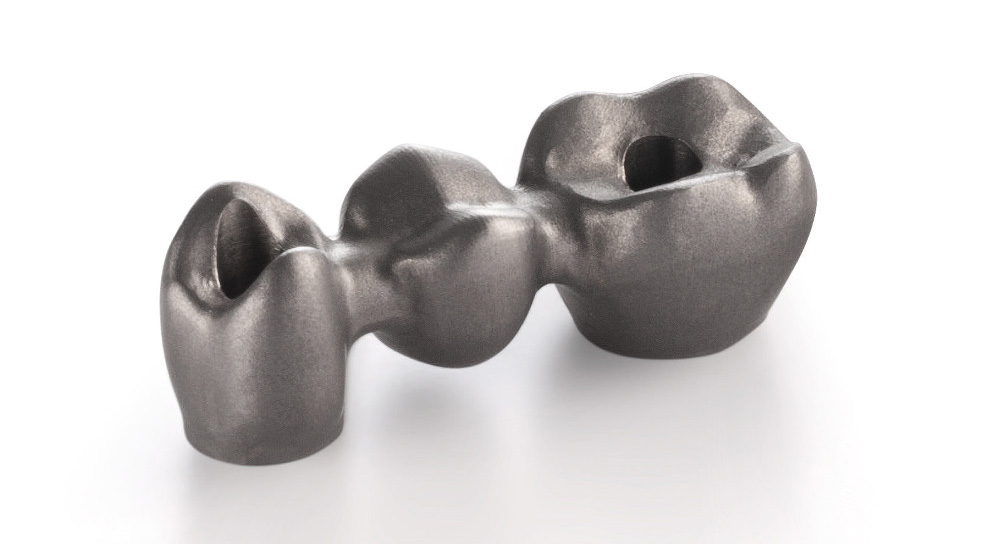 Implants