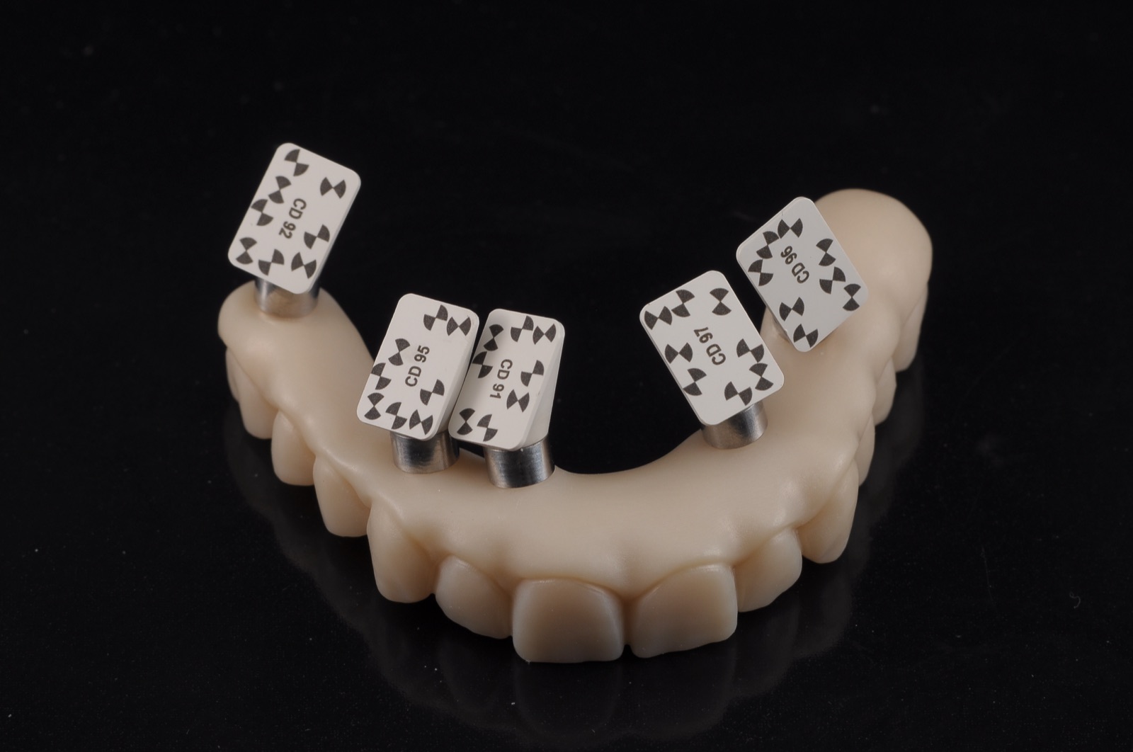 Prothèse fixe sur implant, Laboratoire Dentaire AIDE