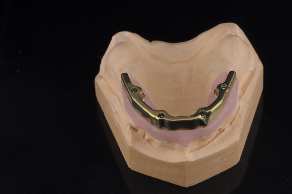 Barres d&rsquo;implants