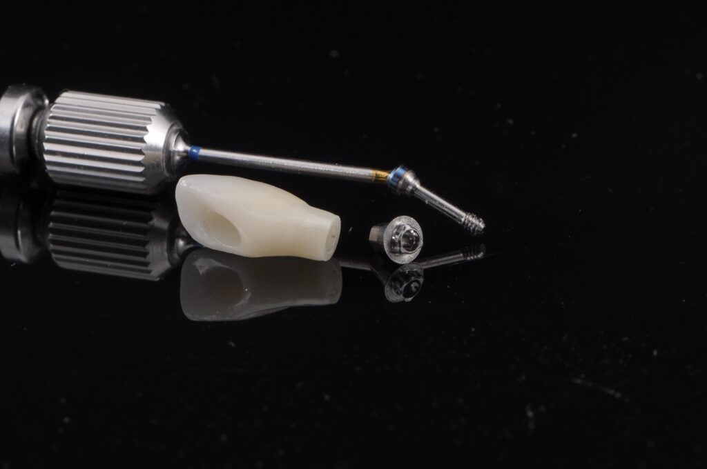 Couronne sur implant avec canal de vis angulé
