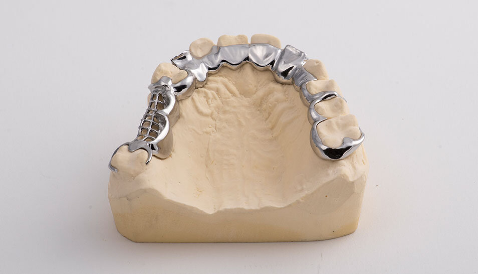 Titanium hygienic bar partial on the model
