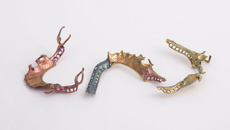 Titanium partial denture frameworks