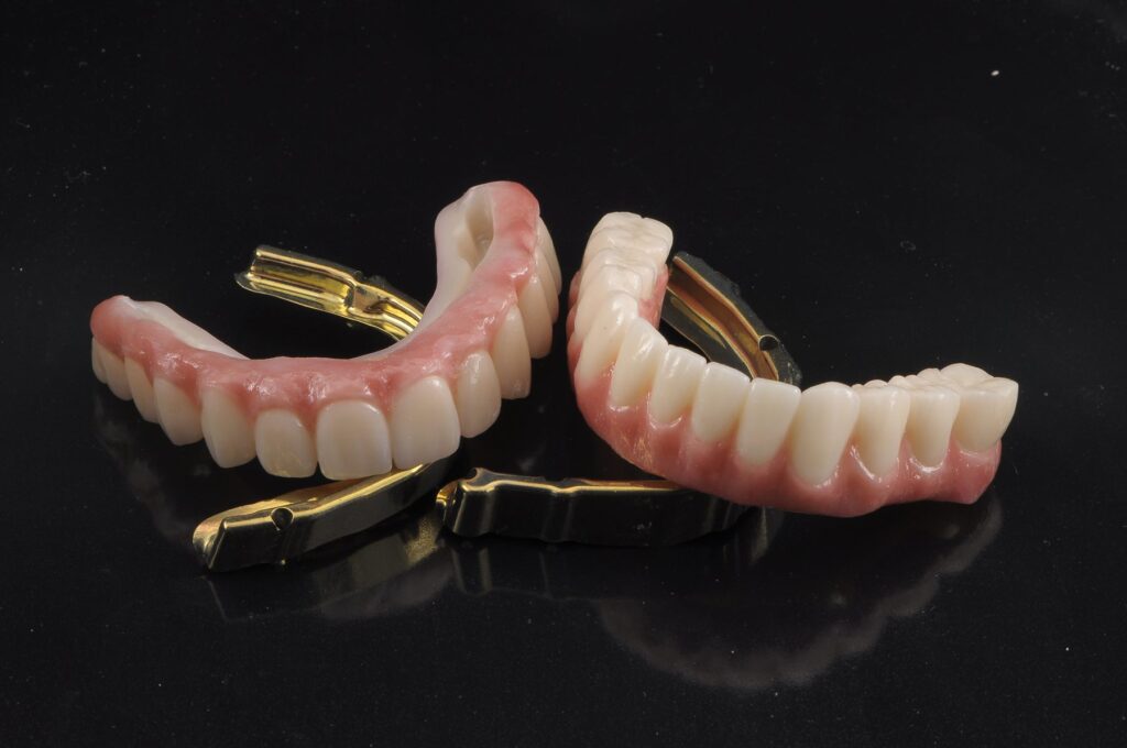 Deux prothèses complètes sur barres d'implants